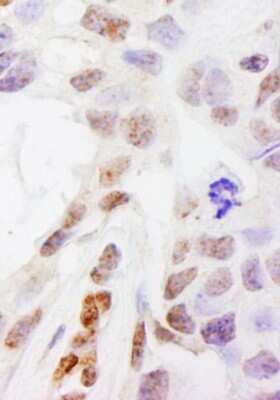 Immunohistochemistry: DHX38 Antibody [NB110-40582]