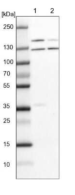 Western Blot: DHX38 Antibody [NBP1-85269]