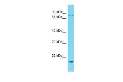 Western Blot: DHX40 Antibody [NBP2-82852]