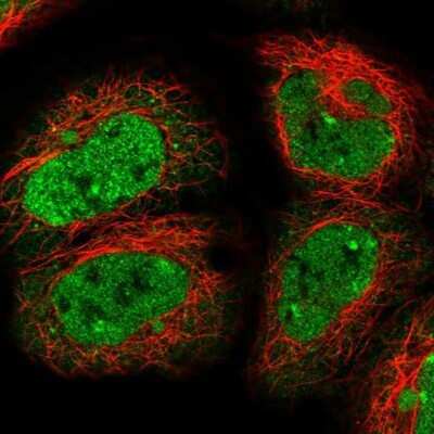Immunocytochemistry/ Immunofluorescence: DHX8 Antibody [NBP2-13923]