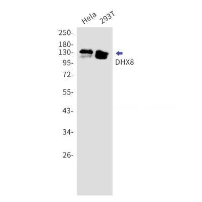 Western Blot: DHX8 Antibody (S04-1I7) [NBP3-15023]