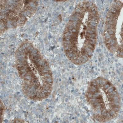 Immunohistochemistry-Paraffin: DIAPH-2 Antibody (CL1111) [NBP2-52966]