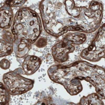 Immunohistochemistry-Paraffin: DIAPH-2 Antibody (CL1113) [NBP2-52967]