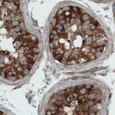 Immunohistochemistry-Paraffin: DIAPH-2 Antibody (CL1113) [NBP2-52967]