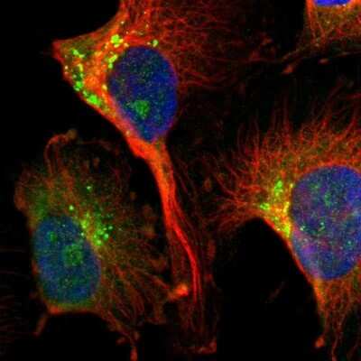 Immunocytochemistry/ Immunofluorescence: DIAPH-2 Antibody [NBP1-85217]