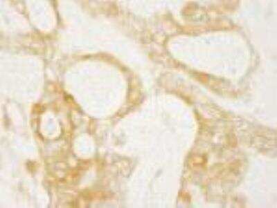 Immunohistochemistry-Paraffin: DIAPH1 Antibody [NB600-231]