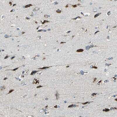 Immunohistochemistry-Paraffin: DIAPH1 Antibody [NBP1-85246]