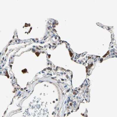 Immunohistochemistry-Paraffin: DIAPH1 Antibody [NBP1-85246]