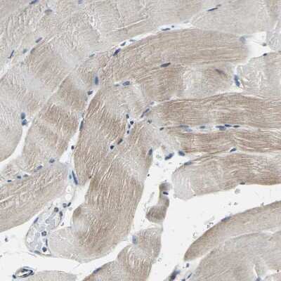 Immunohistochemistry-Paraffin: DIAPH1 Antibody [NBP1-85246]