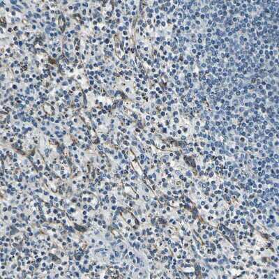 Immunohistochemistry-Paraffin: DIAPH1 Antibody [NBP1-85246]