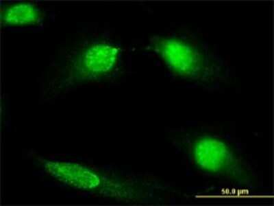 Immunocytochemistry/ Immunofluorescence: DIAPH3 Antibody (4D5) [H00081624-M01]