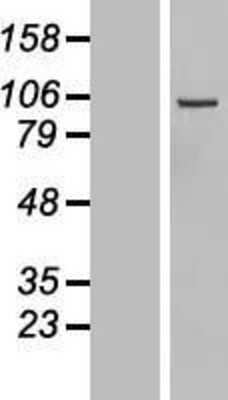 Western Blot: DIAPH3 Overexpression Lysate [NBL1-09883]