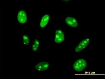 Immunocytochemistry/ Immunofluorescence: DIMT1L Antibody [H00027292-B01P]