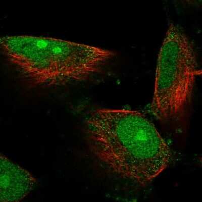Immunocytochemistry/ Immunofluorescence: DIMT1L Antibody [NBP2-30659]