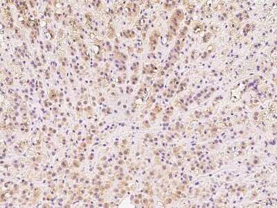 Immunohistochemistry-Paraffin: DIMT1L Antibody [NBP2-97740]