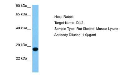 Western Blot: DIO2 Antibody [NBP2-84790]