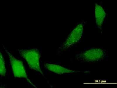Immunocytochemistry/ Immunofluorescence: DIP13B Antibody (1C10) [H00055198-M06]