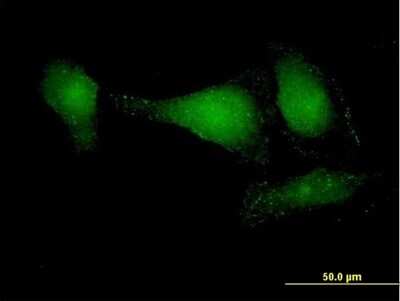 Immunocytochemistry/ Immunofluorescence: DIP13B Antibody [H00055198-B01P]