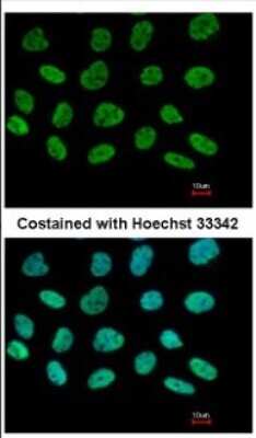 Immunocytochemistry/ Immunofluorescence: DIP13B Antibody [NBP2-16164]