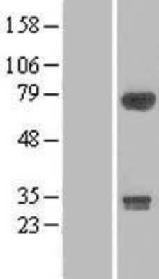 Western Blot: DIP13B Overexpression Lysate [NBL1-07634]