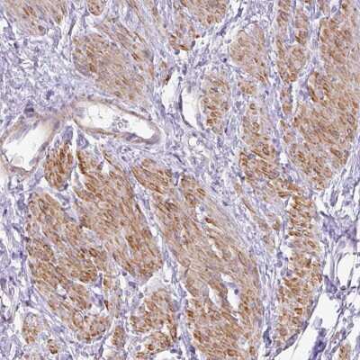 Immunohistochemistry-Paraffin: DIP2A Antibody [NBP2-30966]