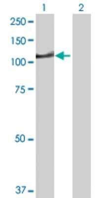 Western Blot: DIP2A Antibody [H00023181-D01P]