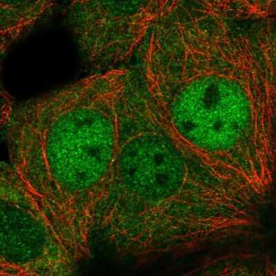 Immunocytochemistry/ Immunofluorescence: DIP2C Antibody [NBP2-57233]