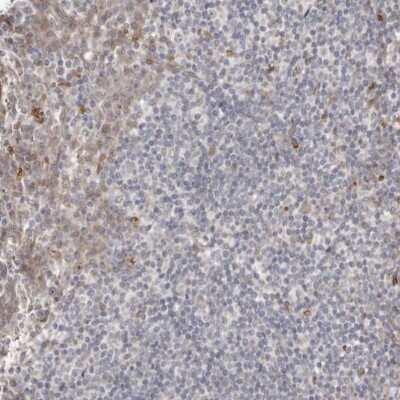 Immunohistochemistry-Paraffin: DIP2C Antibody [NBP1-81461]