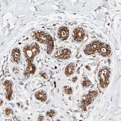 Immunohistochemistry-Paraffin: DIRAS3 Antibody [NBP1-90106]