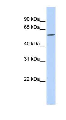 Western Blot: DIRC2 Antibody [NBP1-59634]