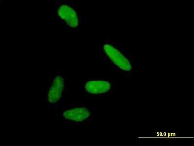 Immunocytochemistry/ Immunofluorescence: DIS3 Antibody [H00022894-B01P]