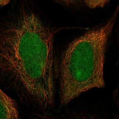 Immunocytochemistry/ Immunofluorescence: DIS3 Antibody [NBP1-85209]