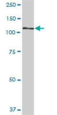 Western Blot: DIS3L Antibody [H00115752-B01P]