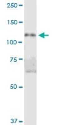 Western Blot: DIS3L Antibody [H00115752-B01P]