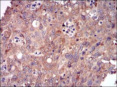 Immunohistochemistry: DIS3L2 Antibody (6C7B2) - BSA Free [NBP2-37316]