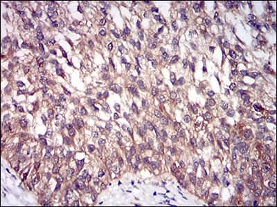 Immunohistochemistry: DIS3L2 Antibody (6C7B2) - BSA Free [NBP2-37316]