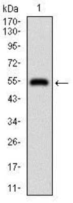 Western Blot: DIS3L2 Antibody (6C7B2)BSA Free [NBP2-37316]