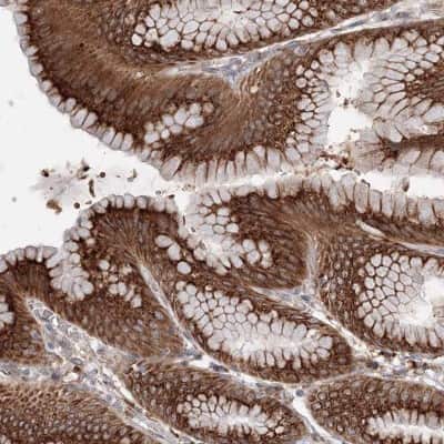 Immunohistochemistry-Paraffin: DIS3L2 Antibody [NBP2-38264]