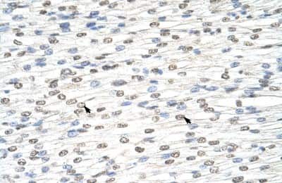 Immunohistochemistry-Paraffin: DIS3L2 Antibody [NBP1-80479]