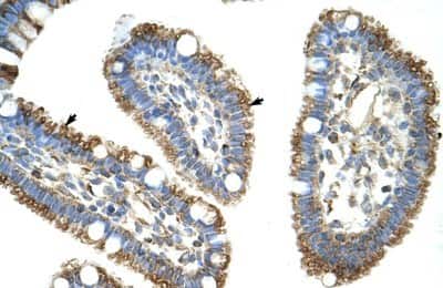 Immunohistochemistry-Paraffin: DIS3L2 Antibody [NBP1-80480]