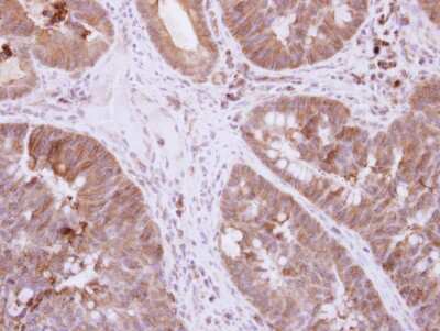 Immunohistochemistry-Paraffin: DIS3L2 Antibody [NBP2-16166]