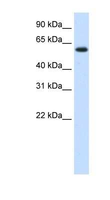 Western Blot: DIS3L2 Antibody [NBP1-80480]