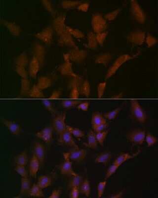 Immunocytochemistry/ Immunofluorescence: DISC1 Antibody (4U5N1) [NBP3-16462]