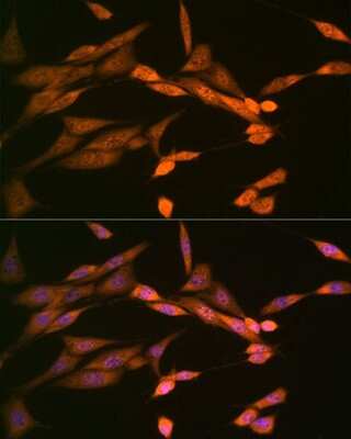 Immunocytochemistry/ Immunofluorescence: DISC1 Antibody (4U5N1) [NBP3-16462]