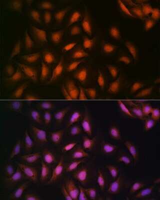 Immunocytochemistry/ Immunofluorescence: DISC1 Antibody (4U5N1) [NBP3-16462]