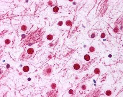 Immunohistochemistry: DISC1 Antibody [NB110-40775]