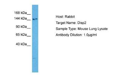Western Blot: DISP2 Antibody [NBP2-84793]