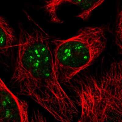 Immunocytochemistry/ Immunofluorescence: DKC1 Antibody [NBP2-55221]