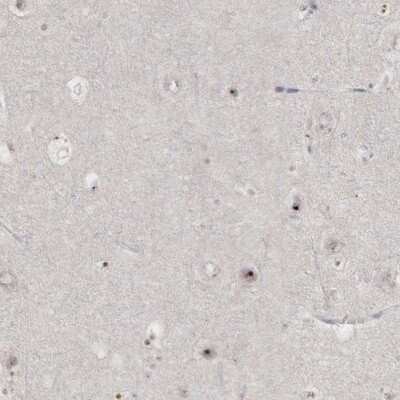 Immunohistochemistry-Paraffin: DKC1 Antibody [NBP1-85156]