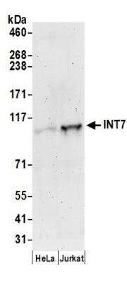 Western Blot: DKFZP434B168 Antibody [NB100-465]